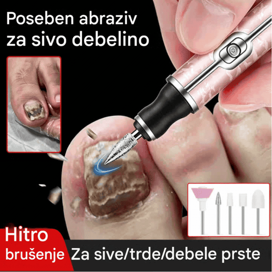 💅👍 Električna pilica za nohte za zdravljenje onihomikoze