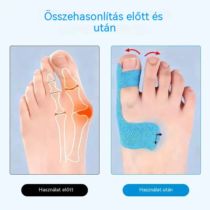 🌞🎉[50/100 db] Rugalmas ujjvédők, égési sérülésekre való tapaszok, tartós sportkötések
