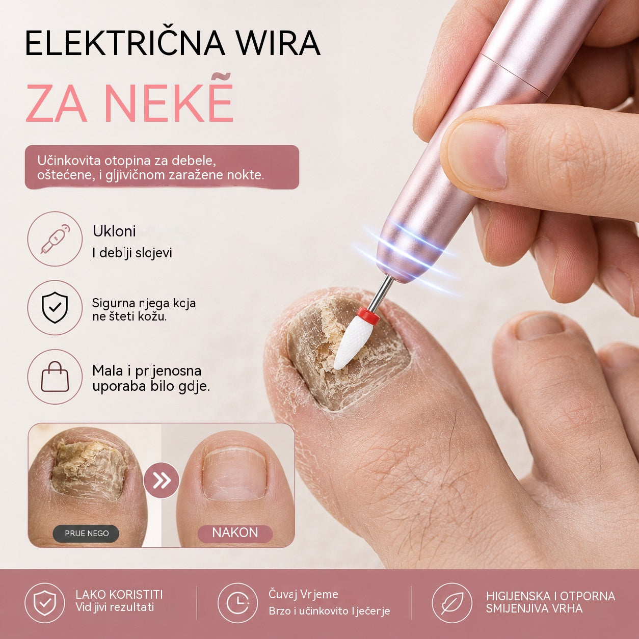 💅👍 Električna turpija za nokte koja se koristi za liječenje onihomikoze (gljivica na noktima)