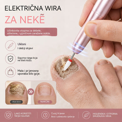 💅👍 Električna turpija za nokte koja se koristi za liječenje onihomikoze (gljivica na noktima)