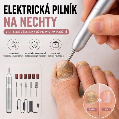 💅👍 Elektrický pilník na nechty používaný na liečbu onychomykózy (plesne nechtov)