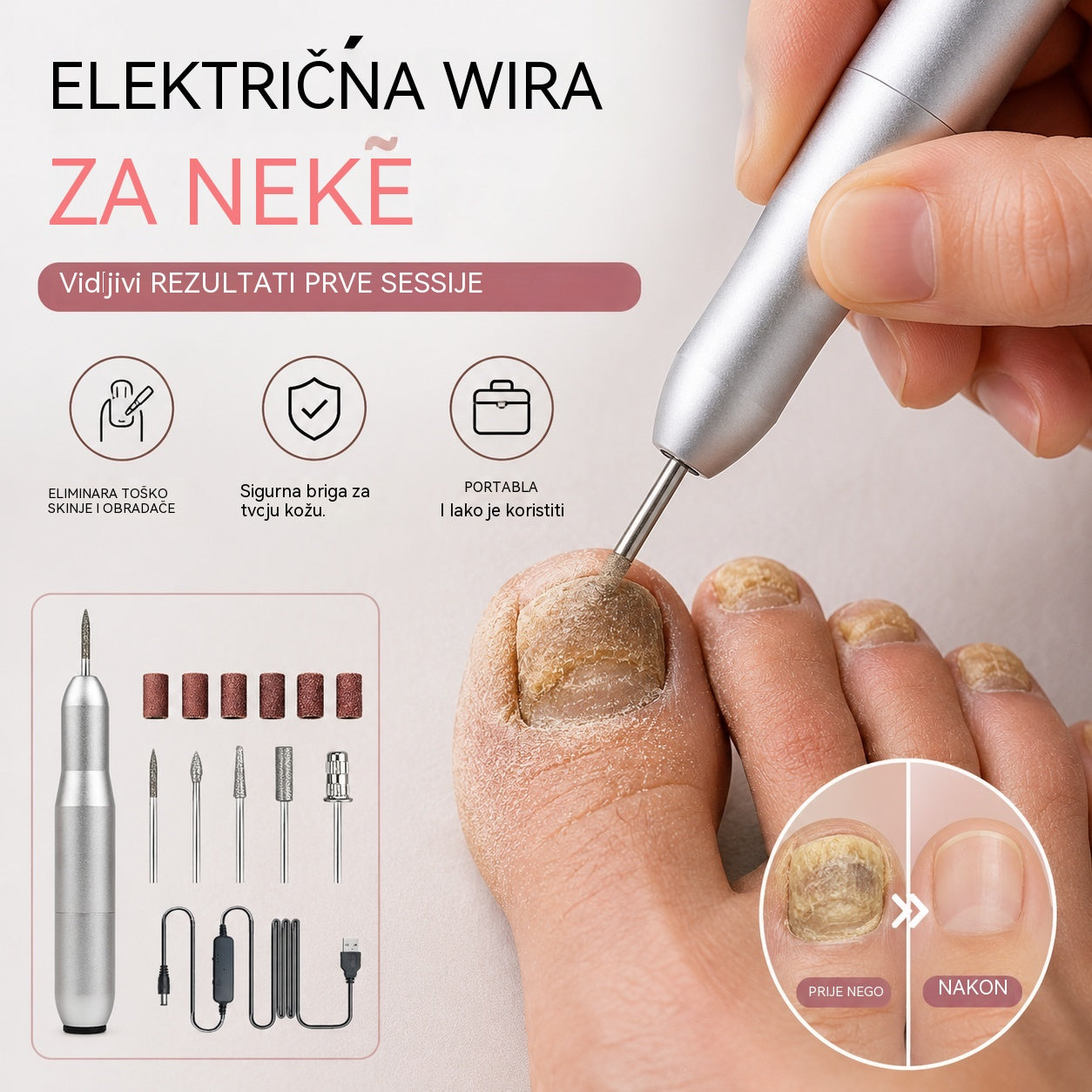 💅👍 Električna turpija za nokte koja se koristi za liječenje onihomikoze (gljivica na noktima)