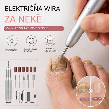 💅👍 Električna turpija za nokte koja se koristi za liječenje onihomikoze (gljivica na noktima)