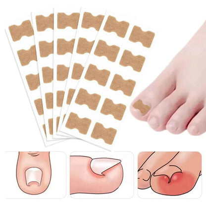 26€【500 adhesivos para la corrección de uñas】Parche autoadhesivo sin adhesivo para la corrección de uñas de los pies